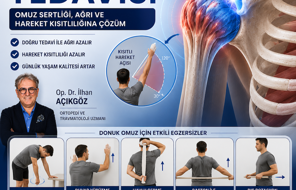 Donuk Omuz Tedavisi ve Egzersizleri